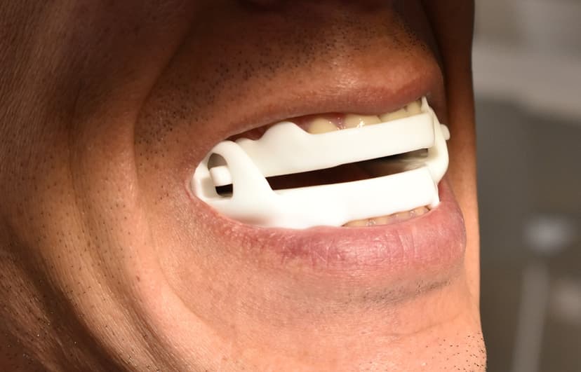 OrthoApnea NOA Gerät für Schlafapnoe-Behandlung in der Fábrica do Sorriso